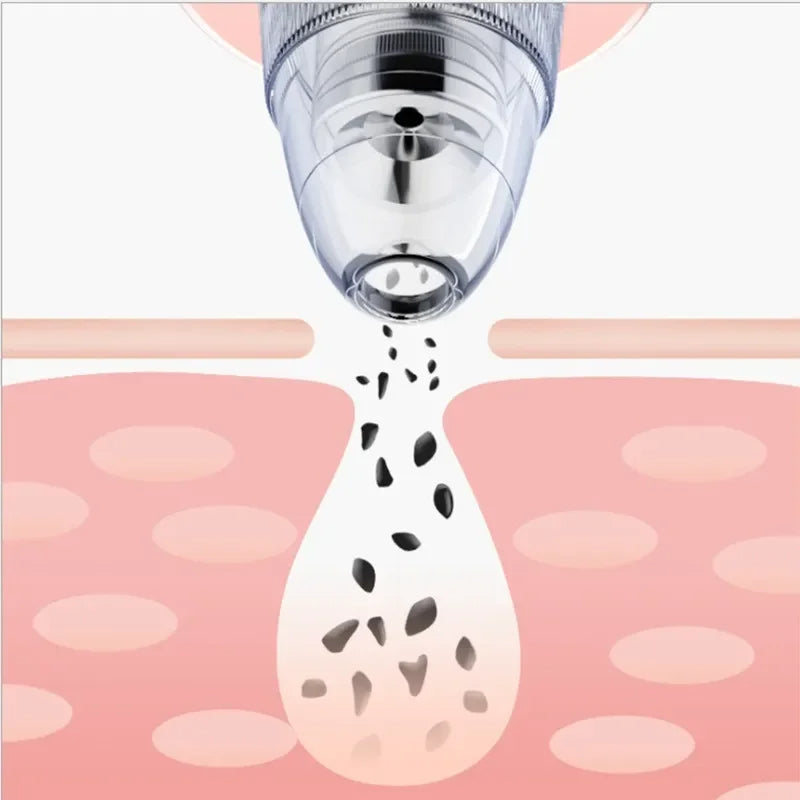 cleanerمزيل الرؤوس السوداء