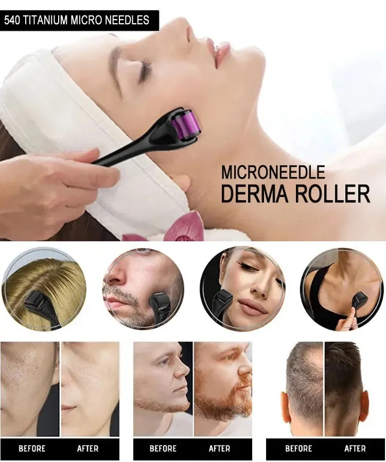 540 Derma Roller 540 ديرما رولر للعناية بالبشرة