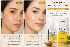 Snail Mucin سيروم الحلزون للوجه