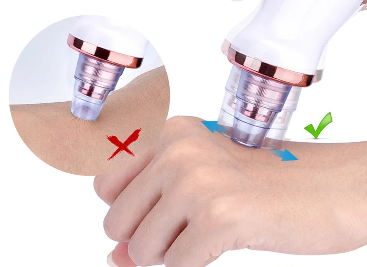 Aspirateur Points Noirs & Nettoyeur de Pores Visage | MATJARRA