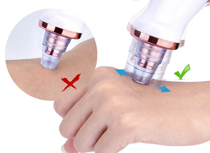 Aspirateur Points Noirs & Nettoyeur de Pores Visage | MATJARRA
