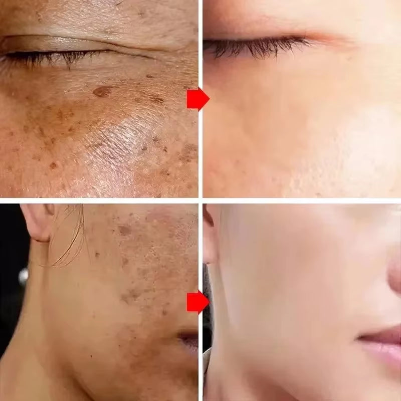 sérum de traitement des taches brunes سيروم علاج للبقع الداكنة