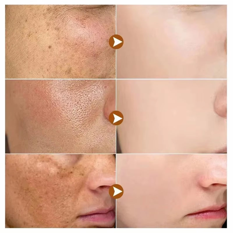 sérum de traitement des taches brunes سيروم علاج للبقع الداكنة