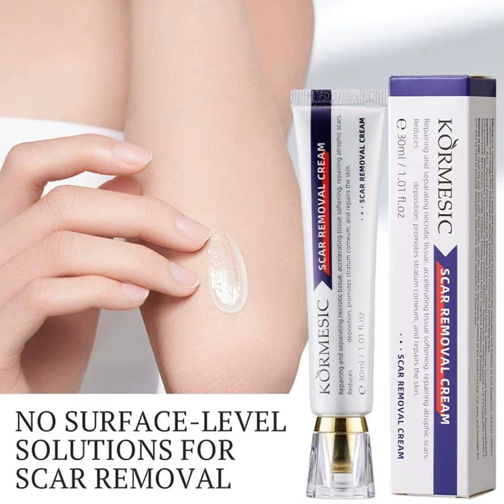 Crème apaisante pour cicatrices visage et corps كريم ومهدئ للندبات للوجه والجسم