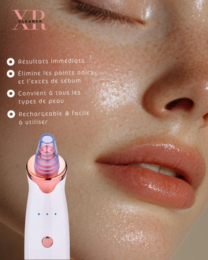 Aspirateur Points Noirs & Nettoyeur de Pores Visage | MATJARRA