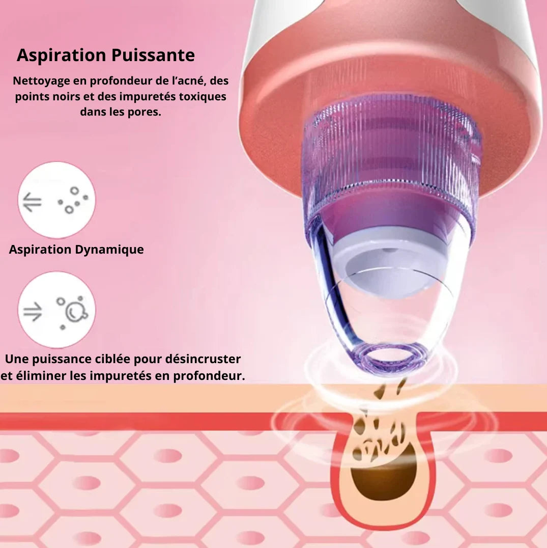 Aspirateur Points Noirs & Nettoyeur de Pores Visage | MATJARRA