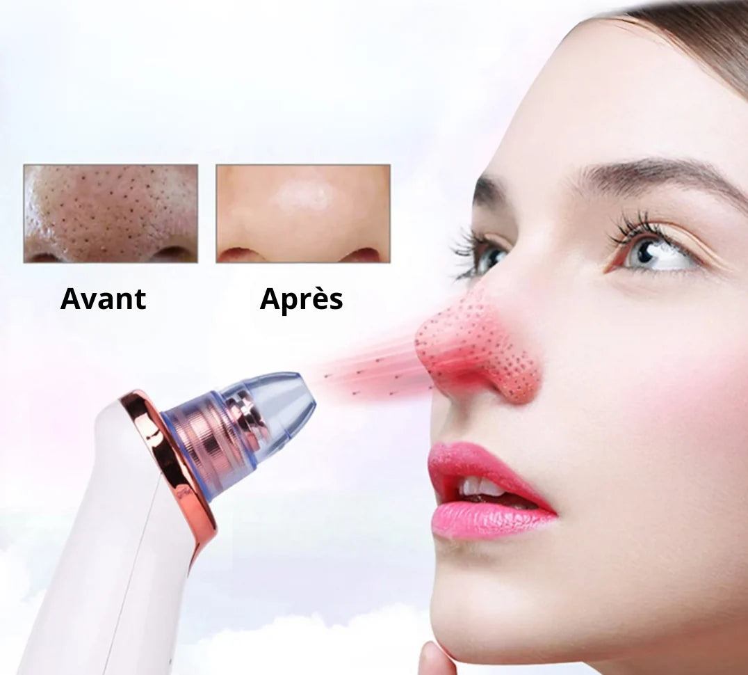 Aspirateur Points Noirs & Nettoyeur de Pores Visage | MATJARRA