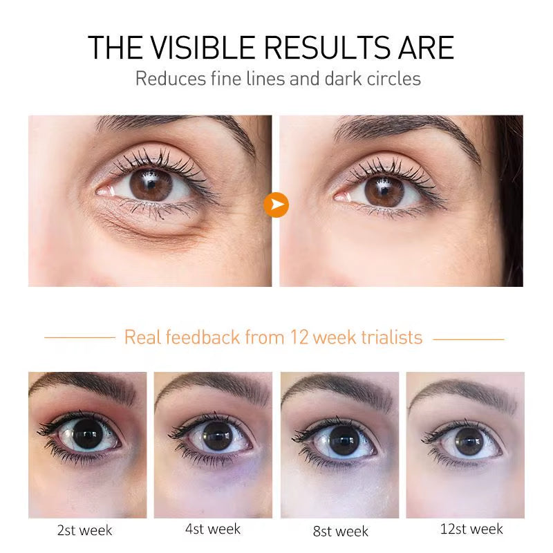 Crème contour des yeux كريم محيط العين