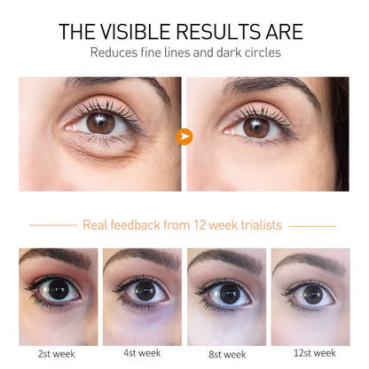 Crème contour des yeux كريم محيط العين