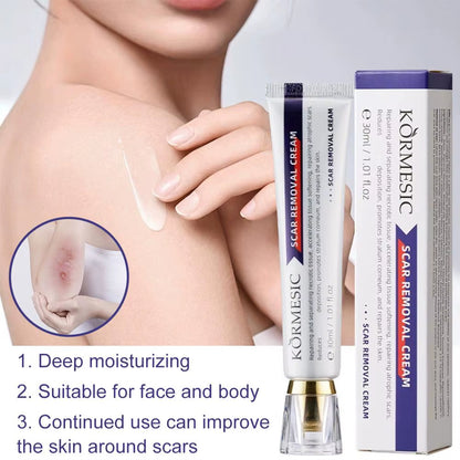 Crème apaisante pour cicatrices visage et corps كريم ومهدئ للندبات للوجه والجسم
