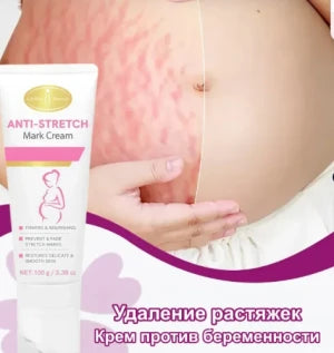 Aishun Beauty Anti-Stretch Mark Cream (100g) كريم أيشون بيوتي المضاد لعلامات التمدد (100 غرام)