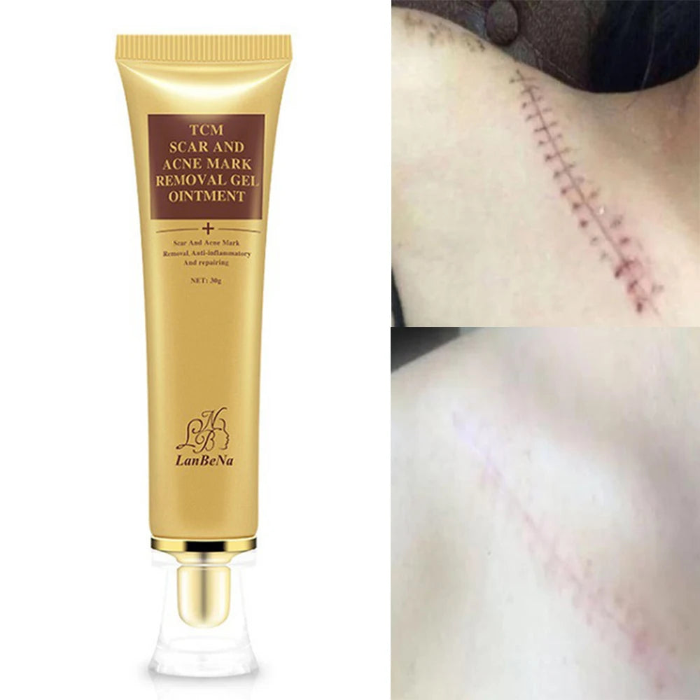 tcm scar جل إزالة الندبات
