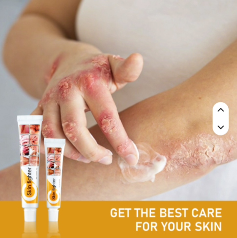 skin soothing cream كريم تهدئة الجلد