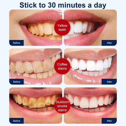 Blanchisseur de dents RtopR مبيض الأسنان