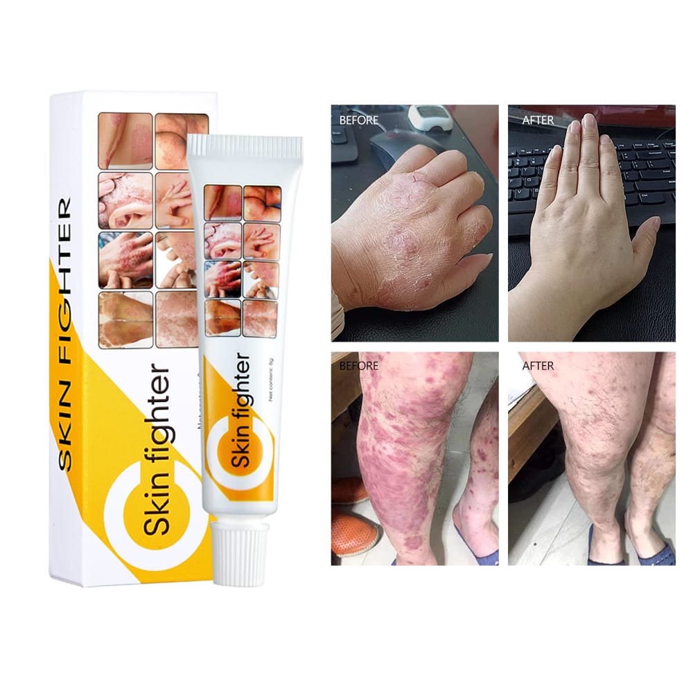 skin soothing cream كريم تهدئة الجلد