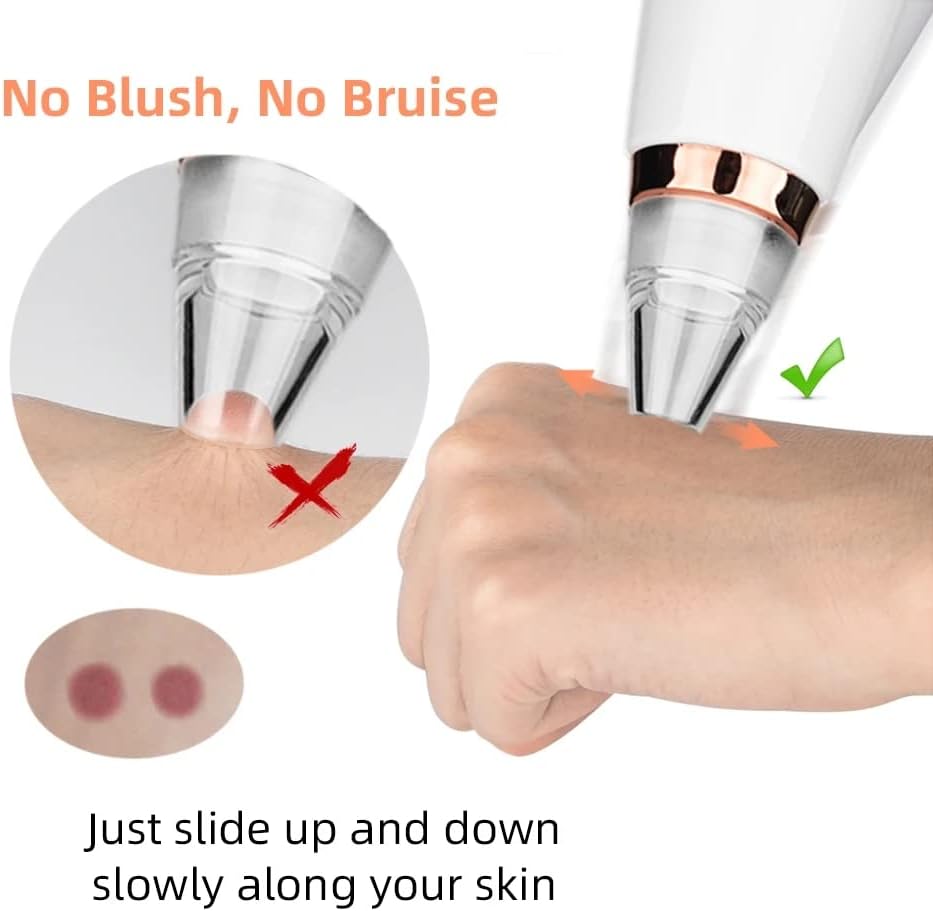 Aspirateur anti-points جهاز إزالة الرؤوس السوداء