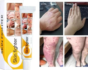 skin soothing cream كريم تهدئة الجلد