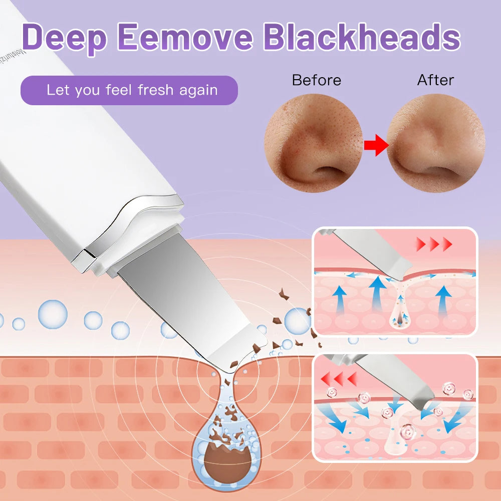 Ultrasonic Skin جهاز تنظيف البشرة
