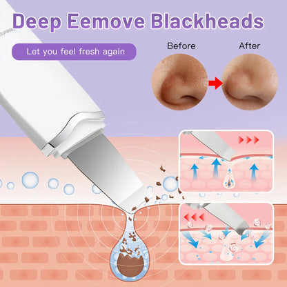 Ultrasonic Skin جهاز تنظيف البشرة