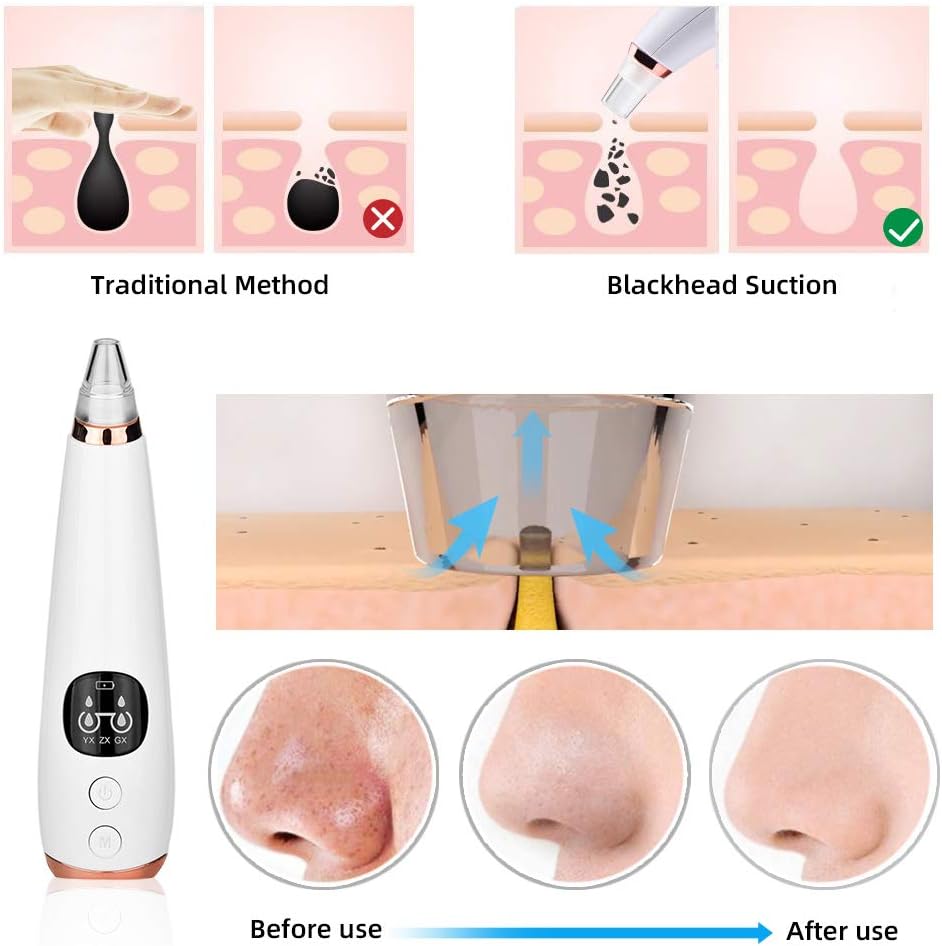 Aspirateur anti-points جهاز إزالة الرؤوس السوداء