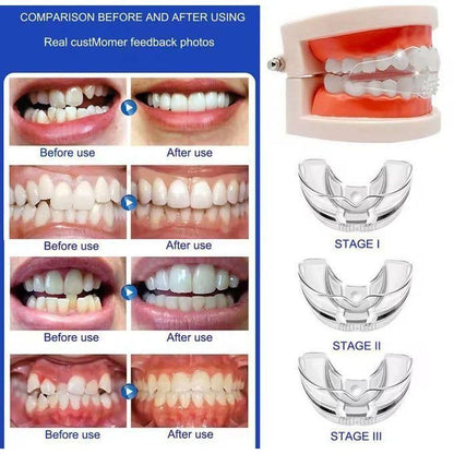 Invisible Braces طقم تقويم الأسنان الشفاف