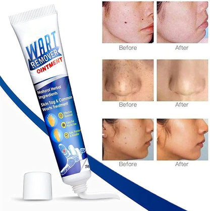 Crème pour l'élimination كريم للتخلص من السموم