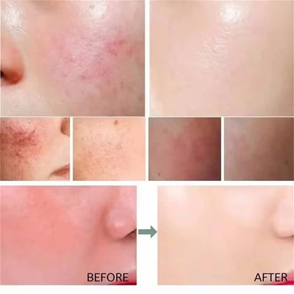Crème réparatrice pour rougeurs كريم إصلاح الاحمرار