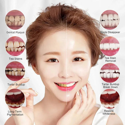 Blanchisseur de dents RtopR مبيض الأسنان