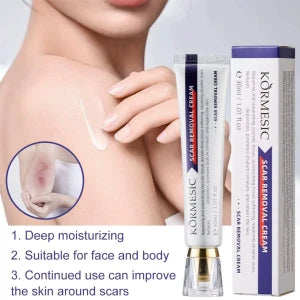 Crème apaisante pour cicatrices visage et corps كريم ومهدئ للندبات للوجه والجسم